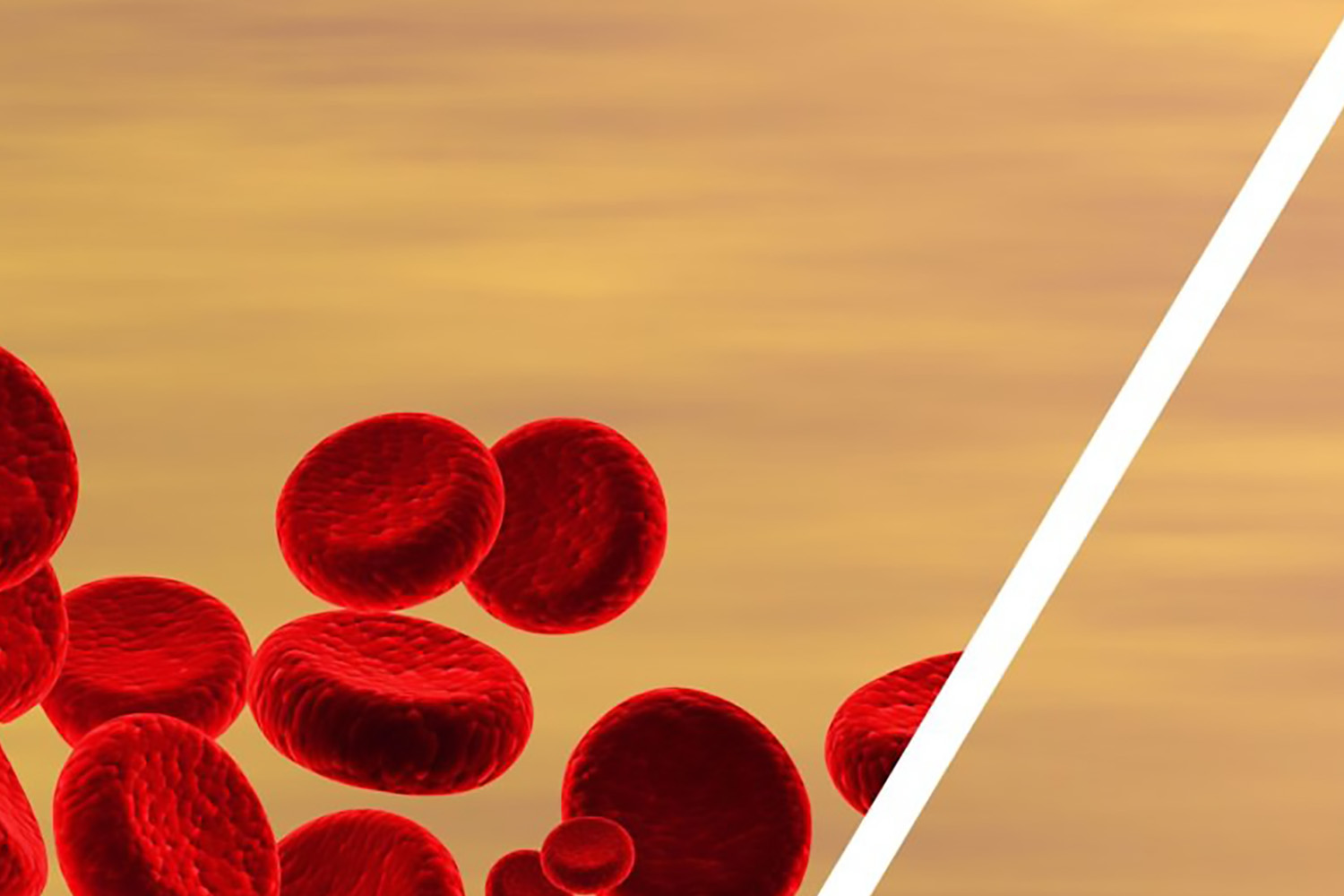 Plasma Separation: Why Do You Need It? How Do You Achieve It?
