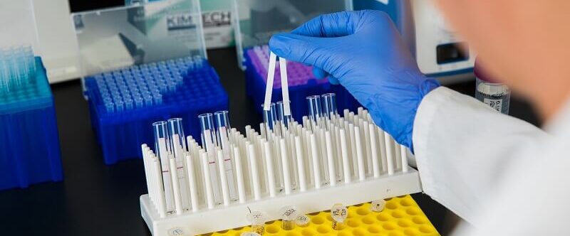 Colloidal Gold 5 point of care testing,POC testing, point-of-care testing, rapid diagnostics, rapid diagnostic, lateral flow, lateral flow assay, infectious disease diagnostic testing, what is a diagnostic test?, what is a rapid diagnostic test?, what is a lateral flow test?, dcn dx, dcn diagnostics, brendan o'farrell, rapid diagnostic test, what is a rapid diagnostic, what is lateral flow, point-of-need testing, immunoassay, sample collection, sample prep, microfluidics, lateral flow test, lateral flow test strips