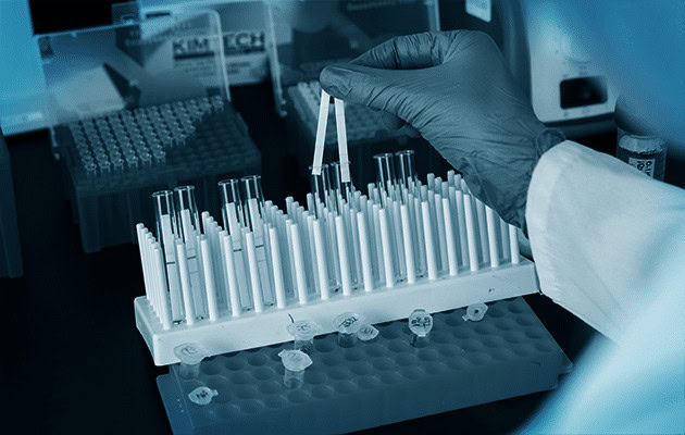 point of care testing,POC testing, point-of-care testing, rapid diagnostics, rapid diagnostic, lateral flow, lateral flow assay, infectious disease diagnostic testing, what is a diagnostic test?, what is a rapid diagnostic test?, what is a lateral flow test?, dcn dx, dcn diagnostics, brendan o'farrell, rapid diagnostic test, what is a rapid diagnostic, what is lateral flow, point-of-need testing, immunoassay, sample collection, sample prep, microfluidics, lateral flow test
